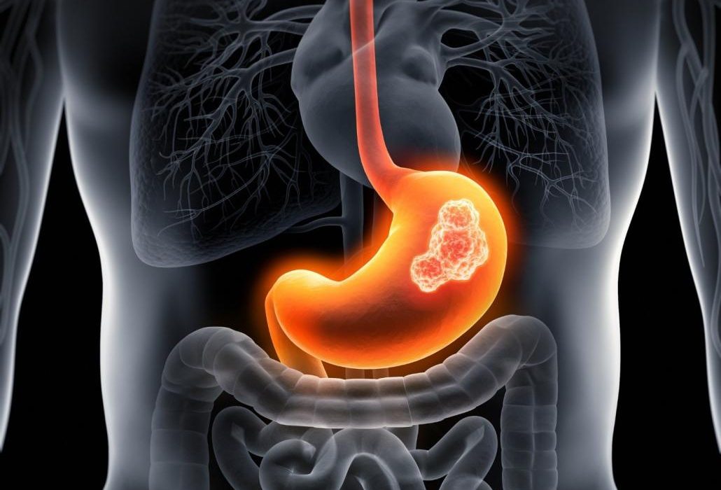 مصرف مواد مخدر و افزایش سرطانهای دستگاه گوارش